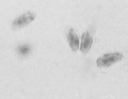 Neolentiporus maculsatissimus 5, Basidiosporas binucleadas